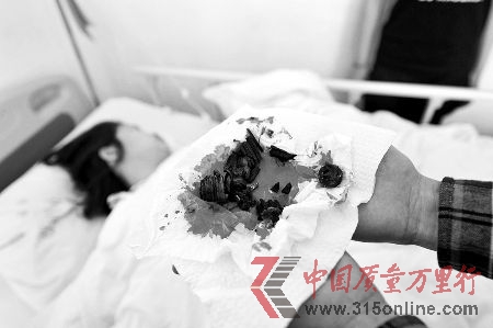 经过抢救后,女子脱离了生命危险,但依然非常虚弱,连说话的力气也没有。医生在手术中,从该女子体内取出一二十块碎片,其中包括铁环、螺丝和大塑料块等,触目惊心。 CFP 经过抢救后,女子脱离了生命危险,但依然非常虚弱,连说话的力气也没有。医生在手术中,从该女子体内取出一二十块碎片,其中包括铁环、螺丝和大塑料块等,触目惊心。 CFP